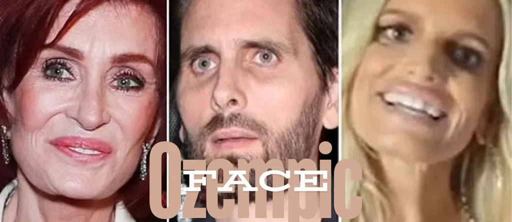 how to avoid semaglutide face What is Ozempic Face and How to Avoid It?