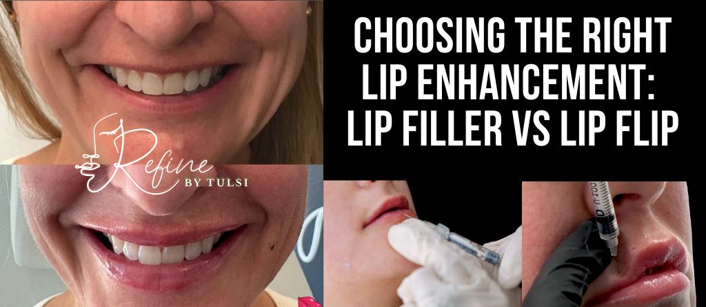 Lip Filler and Lip Flip Options for Lip Augmentation at Refine by Tulsi Med Spa in Chicago