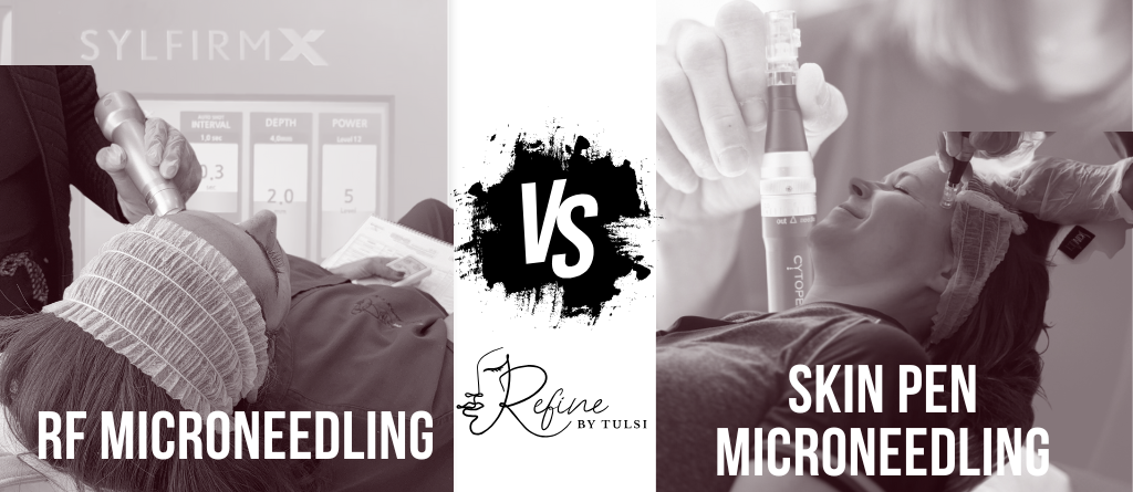 Skin Pen Microneedling and RF Microneedling at Refine by Tulsi Med Spa in Chicago IL