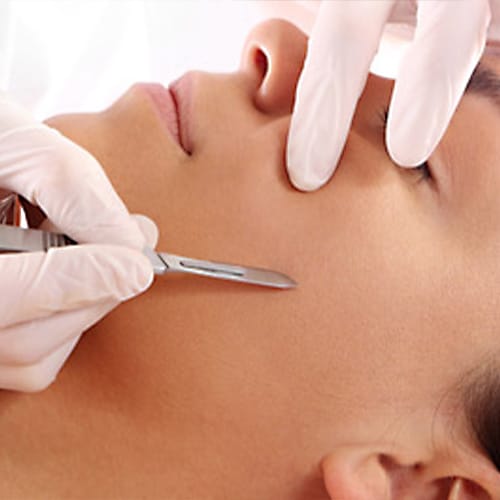 Dermaplaning performed at Refine by Tulsi Med Spa in Chicago