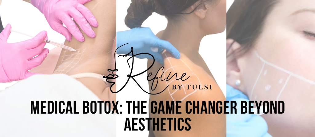 Medical Botox for Masseter, TMJ, Migraines and Sweating at Refine by Tulsi Med Spa