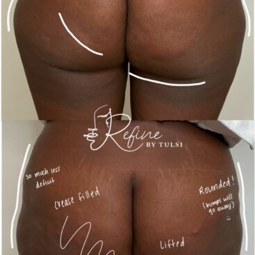 Liquid BBL in Lincoln Park ar Refine by Tulsi