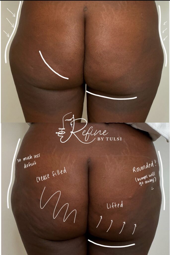 Liquid BBL in Lincoln Park ar Refine by Tulsi