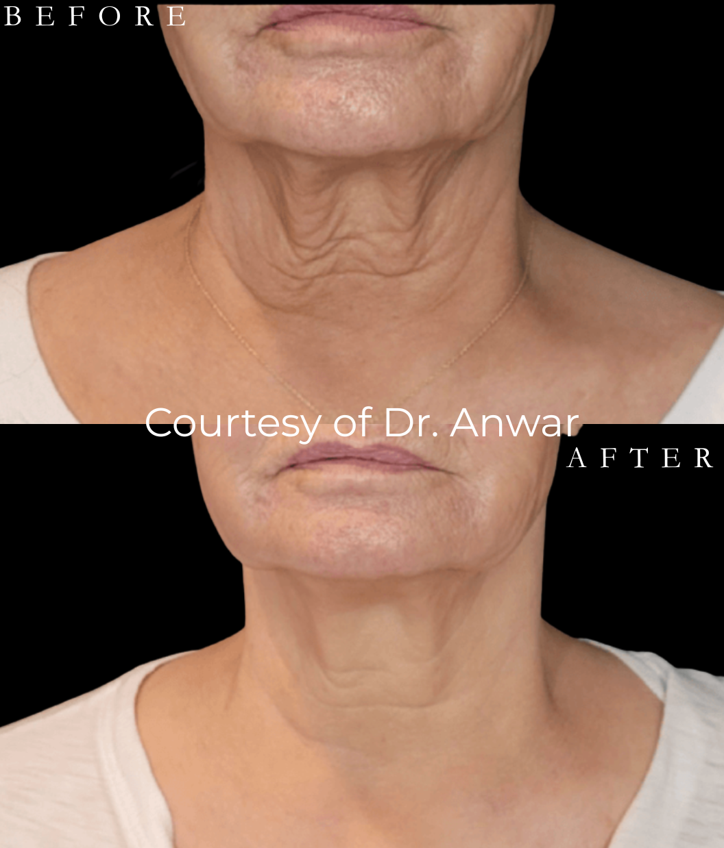 Before & After - Vertical (2)