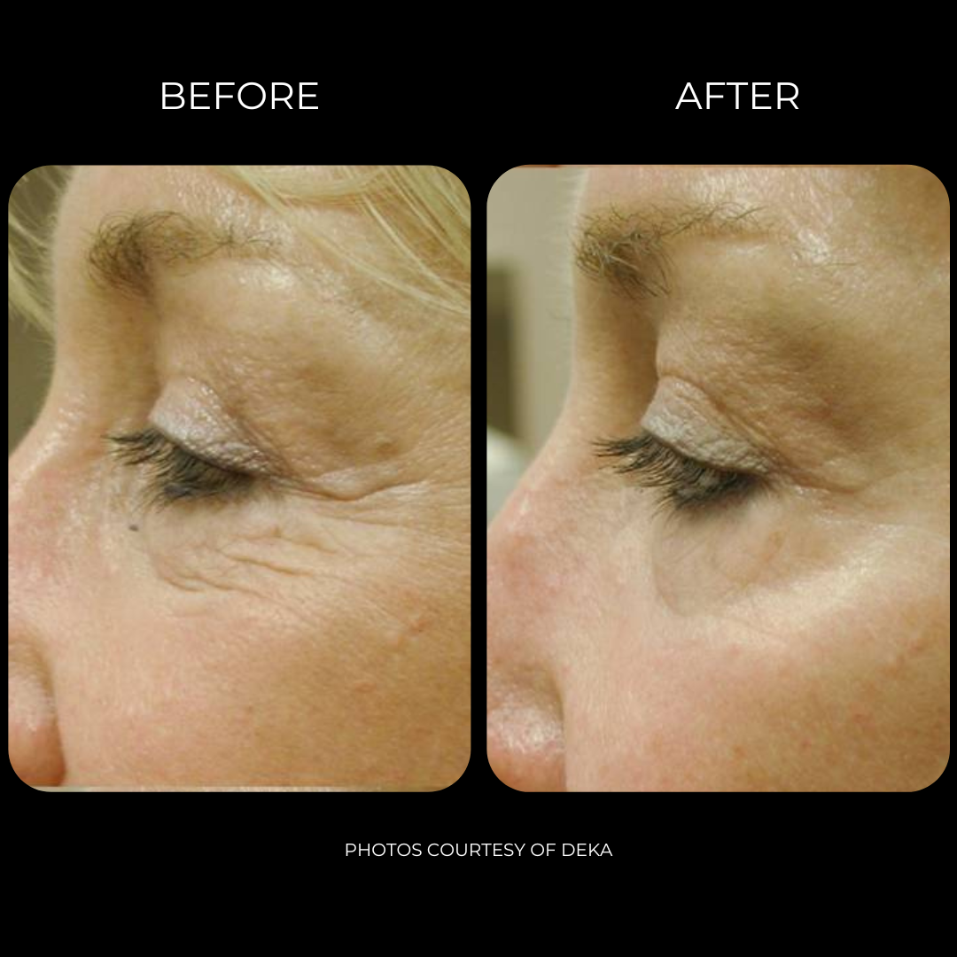 SmartxidePro_Before&After 9