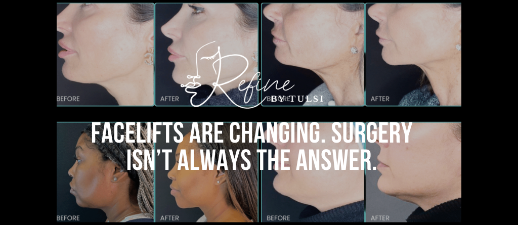 The New Facelift Alternative in Chicago at Refine by Tulsi Non-Surgical, Strategic, and Natural