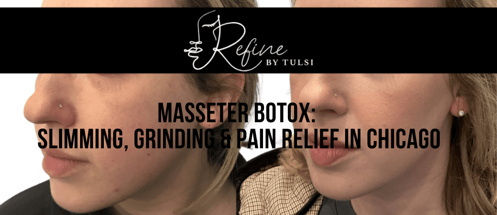 Masseter Botox_ Slimming, Grinding & Pain Relief in Chicago