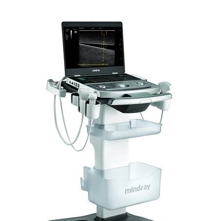 The advanced Mindray ultrasound platform used for guided injectables at Refine by Tulsi